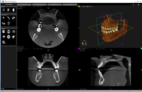 CS 3D Imaging